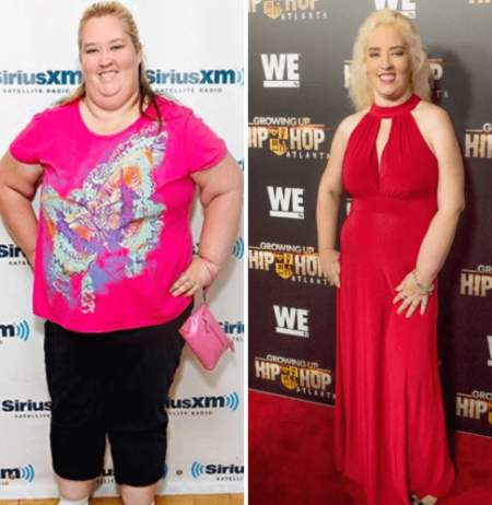 Mama June opted for gastric sleeve surgery in order to undergo weight loss.